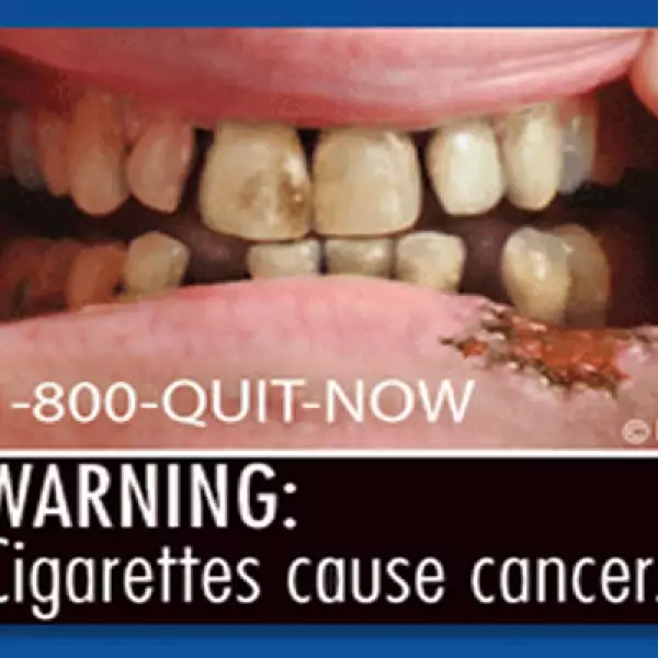 Entre las imágenes difundidas por la Administración de Alimentos y Medicinas de Estados Unidos (FDA, por sus siglas en inglés) hay dientes y encías putrefactas y un hombre con traqueotomía.