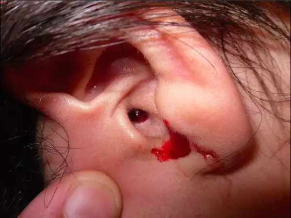 Persona sangrando en honor a Beyonce