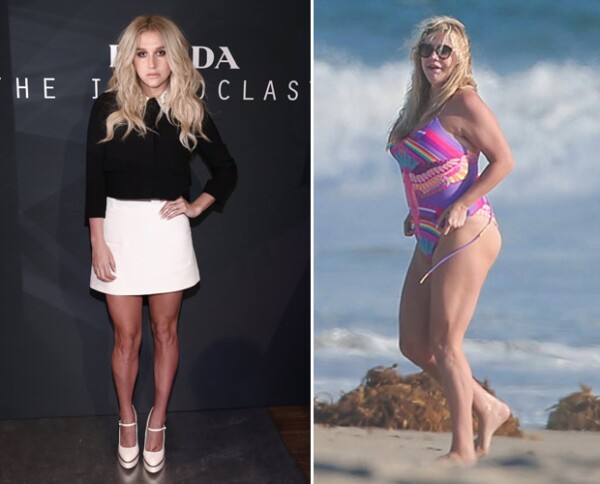 Kesha en 2015 vs Kesha en 2016