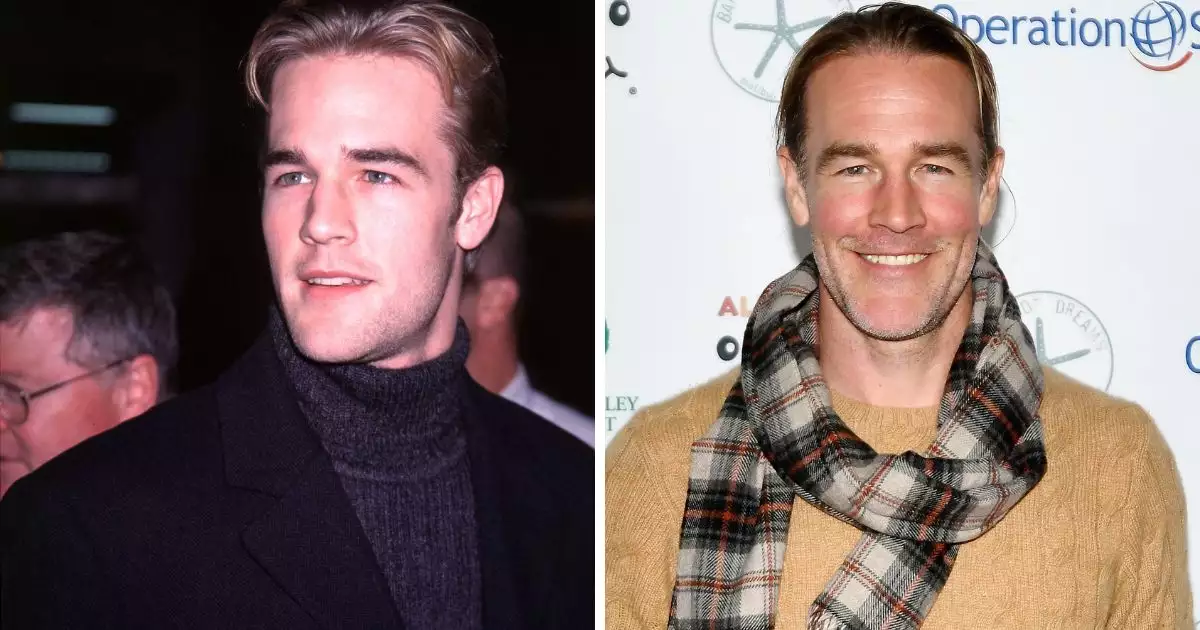 James-Van-Der-Deek-Antes-Despues.jpg