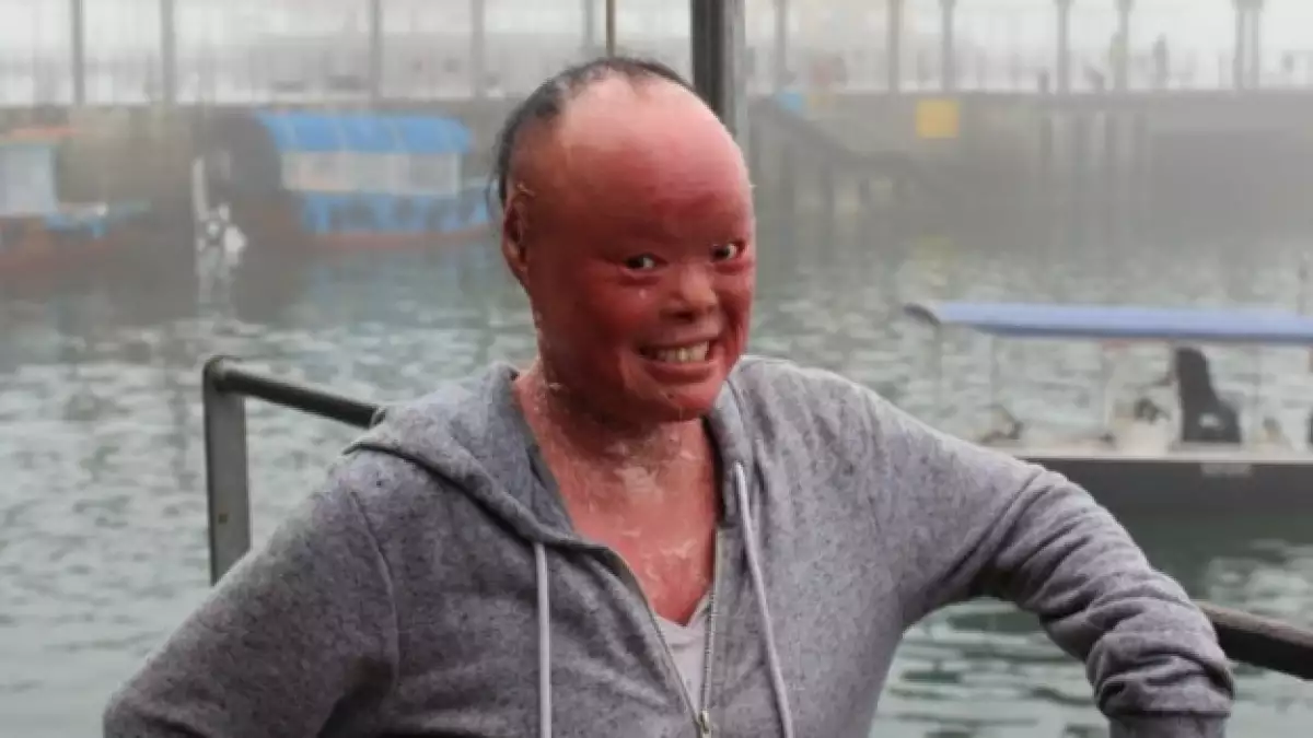 mui thomas