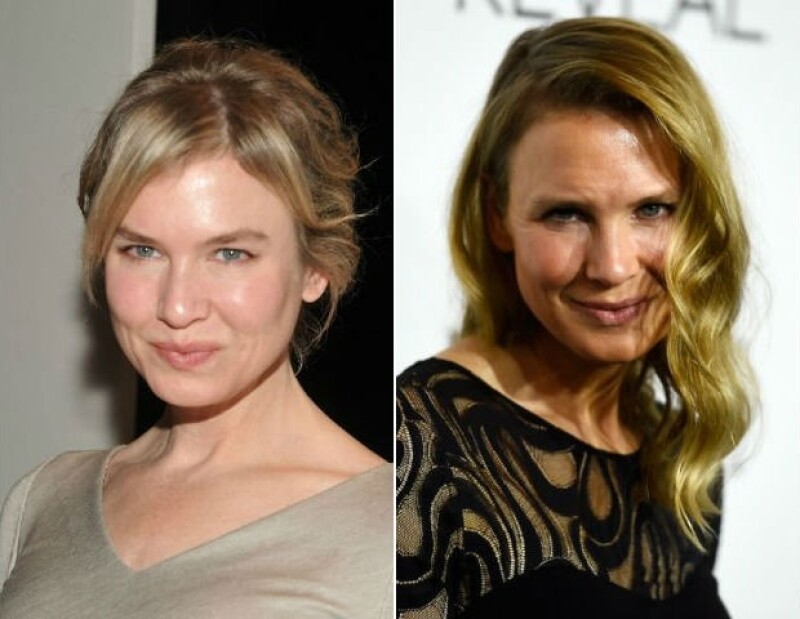 Irreconocible es la mejor forma de describir la nueva apariencia de Renée Zellweger.