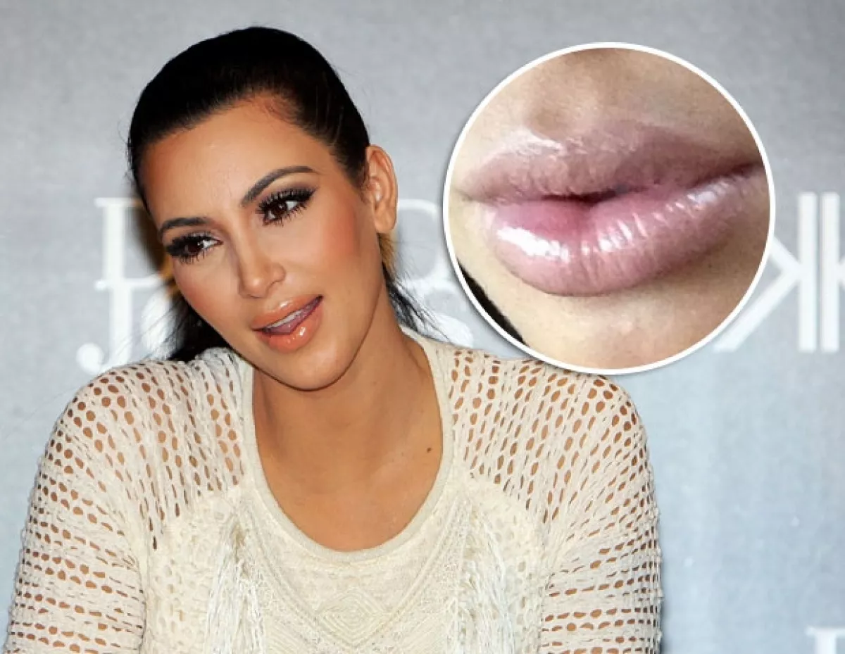kim aseguró que el aumento en el volumen de sus labios se debe a su embarazo.