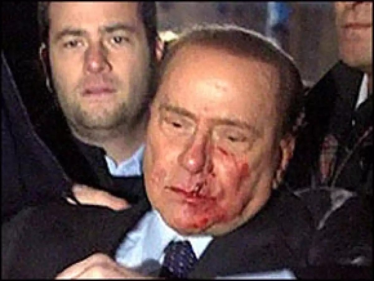Las imágenes televisivas mostraron al Primer Ministro italiano con sangre en la boca y debajo de la nariz y un ojo, mientras sus asistentes lo ayudaban a ponerse de pie.