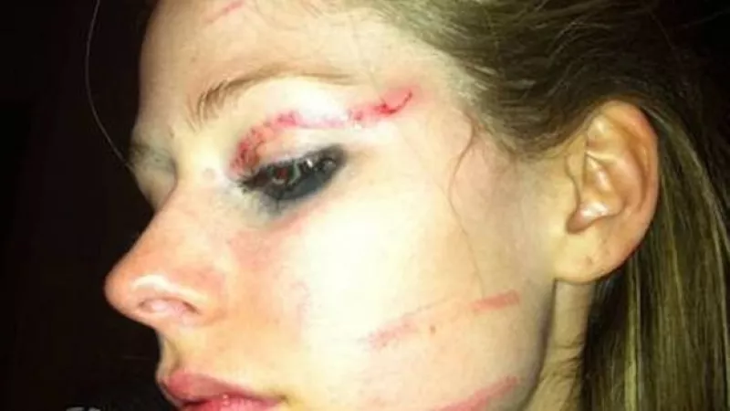 La joven cantante canadiense Avril Lavigne fue severamente agredida por cinco personas a las afueras del bar del Roosevelt Hotel de Hollywood.
