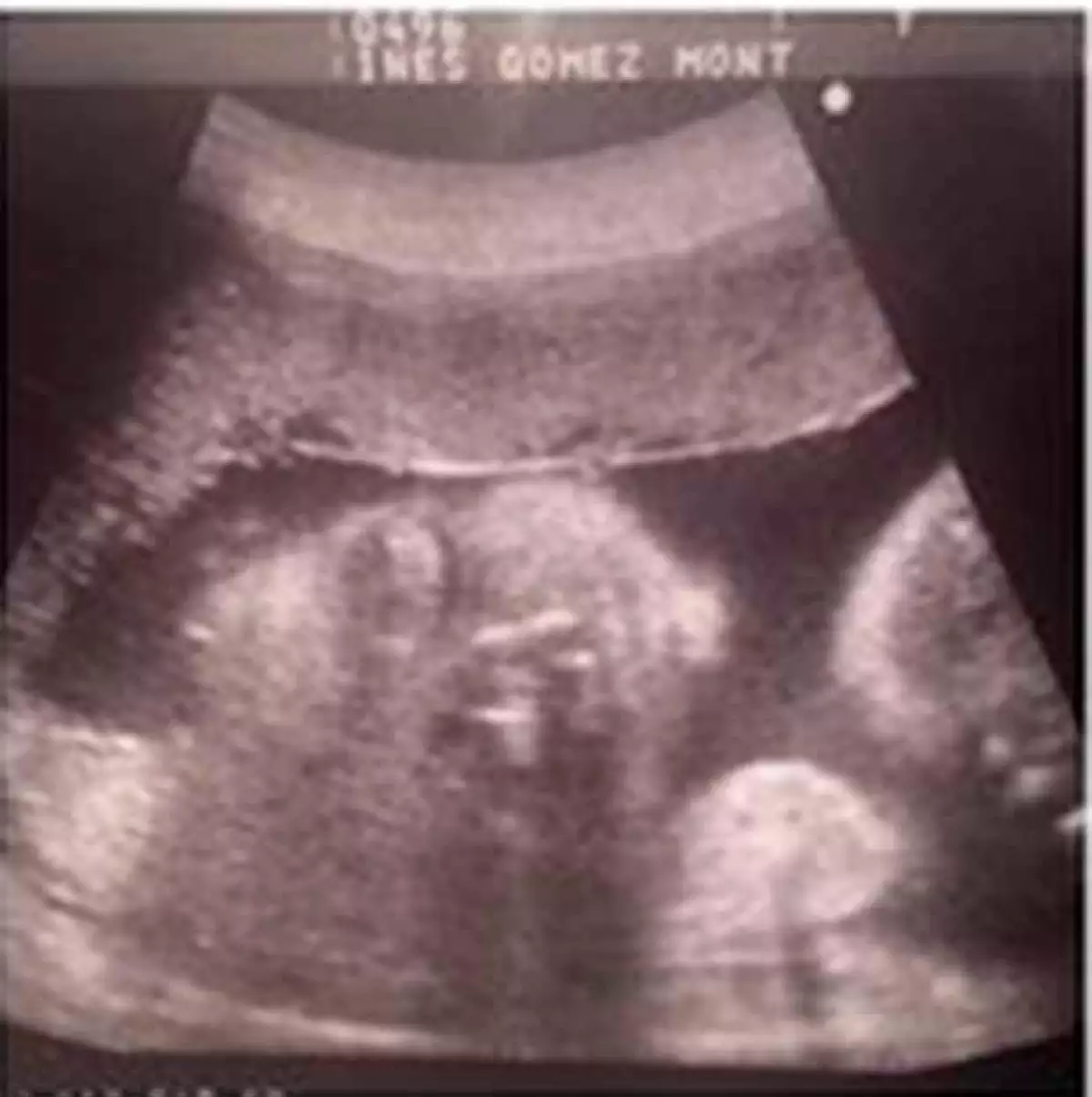 Este es el primer ultrasonido que la conductora comparte de este, su tercer embarazo.