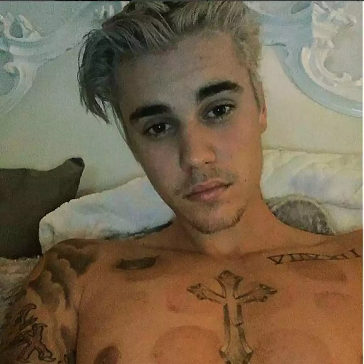 El astro pop publicó en Instagram una fotografía que preocupó a sus fans, ¿qué son esas marcas?