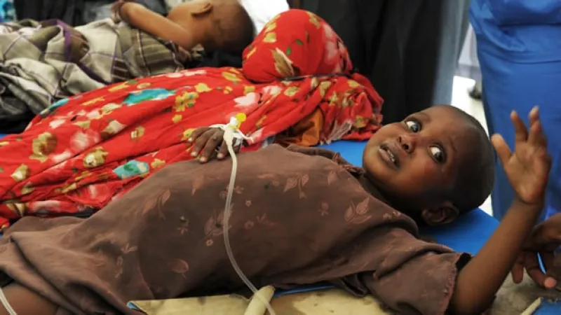 Un niño padece hambre en Somalia