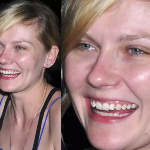 Kirsten Dunst sabe que sus dientes están chuecos, pero no le importa pues ella lo sabe y no desea ponerle remedio a su sonrisa que podría estar mucho mejor.
