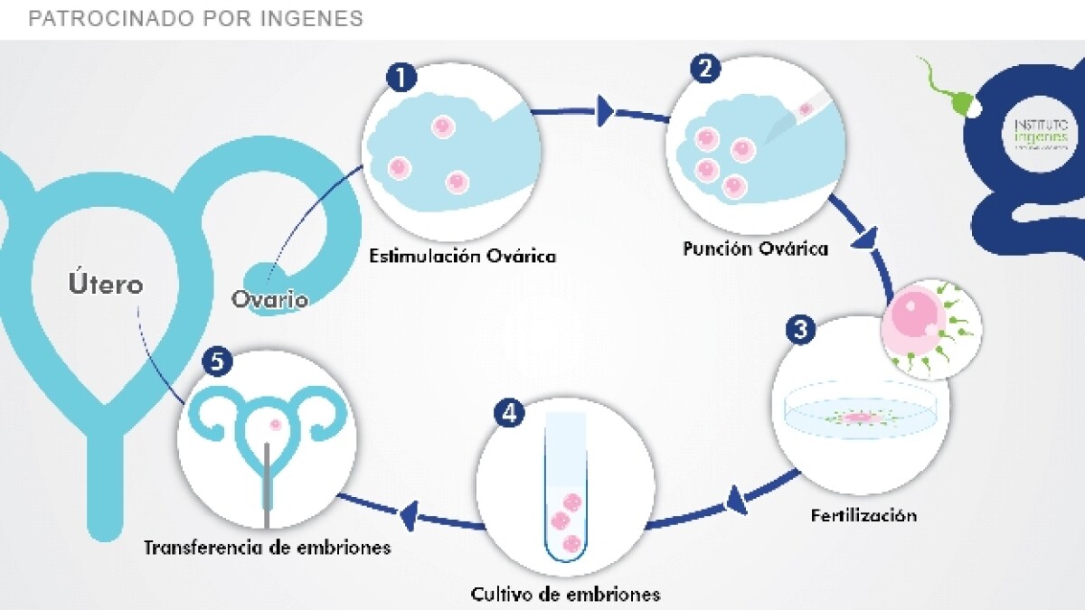 Fecundación In Vitro Proceso Tiempo Fertilización in vitro (FIV) en México