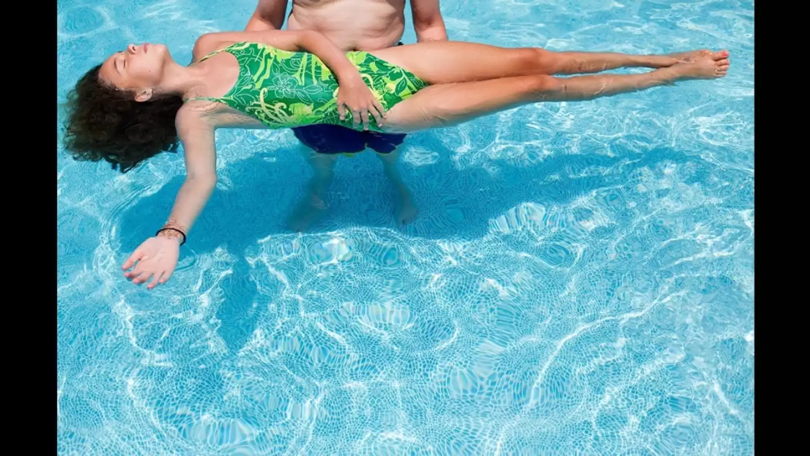 Hannah escoliosis idiopatica alberca