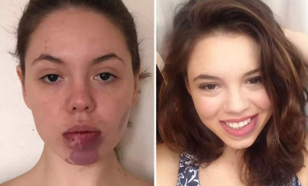 A sus 24 años, Celina Leroy se mostró sin una gota de maquillaje y habló por primera vez de la marca de nacimiento que la avergonzaba.