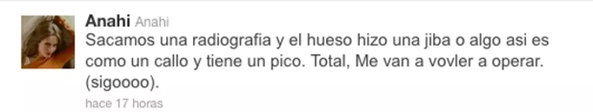 La ex RBD aseguró a sus fans que tendrá que volver a operarse la nariz por cuestiones de salud.