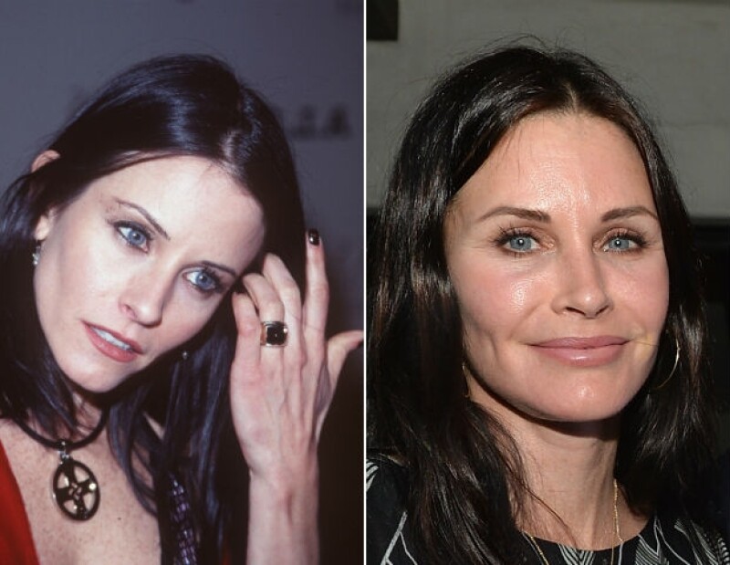Courteney Cox convirtió al botox y las operaciones en sus "best friends".