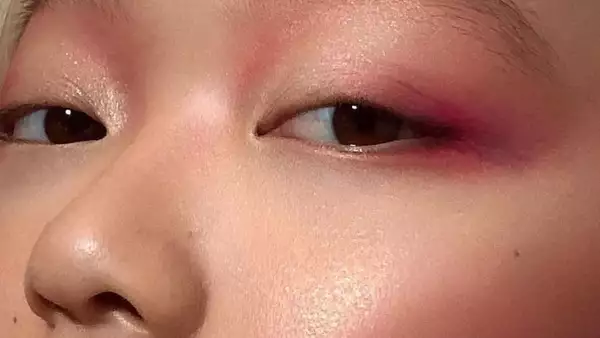  beauty blindness 