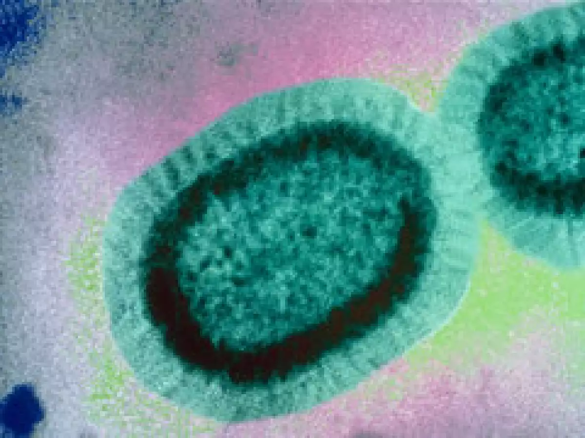 De acuerdo al estudio de Ernst & Young la influenza porcina puede llegar a ser una pandemia. (Foto: Cortesía Laboratorio Sanofi-Aventis y Sanofi-Pasteur)