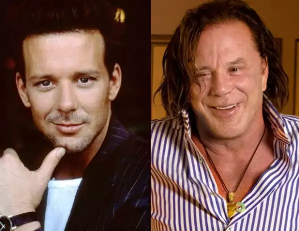 Mickey abusó tanto de las cirugías faciales que terminó por adquirir una imagen totalmente diferente a la que se le conoció.