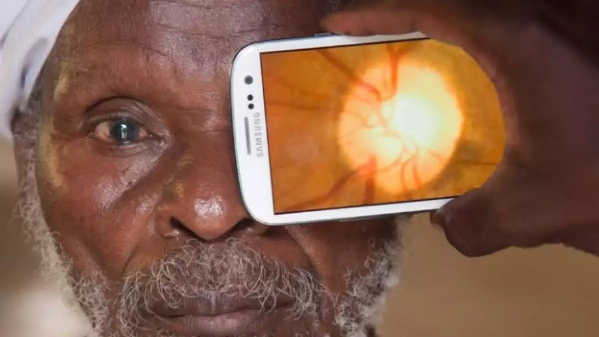 app examenes oculares