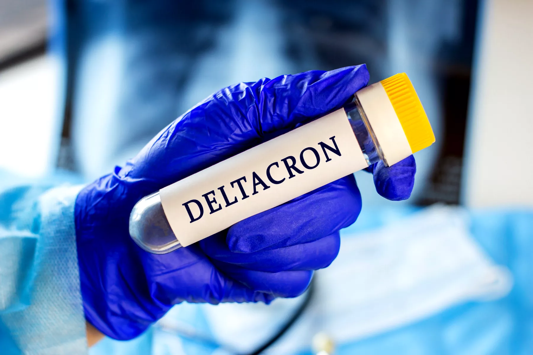 muestra nueva variante deltacron