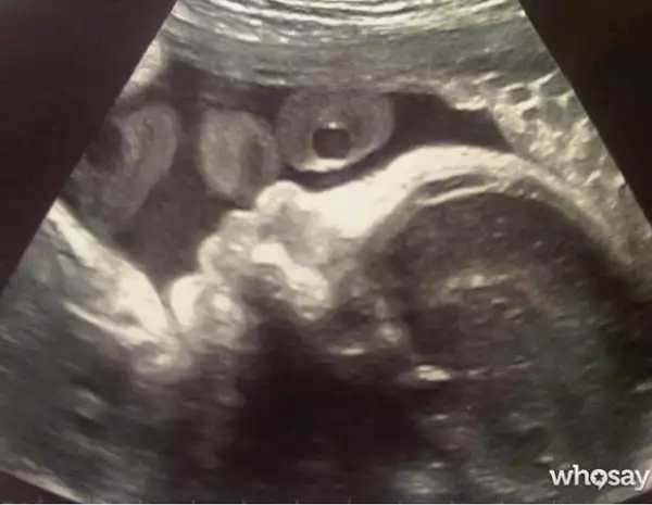 La imagen que compartió Gerard hace algunos meses.
