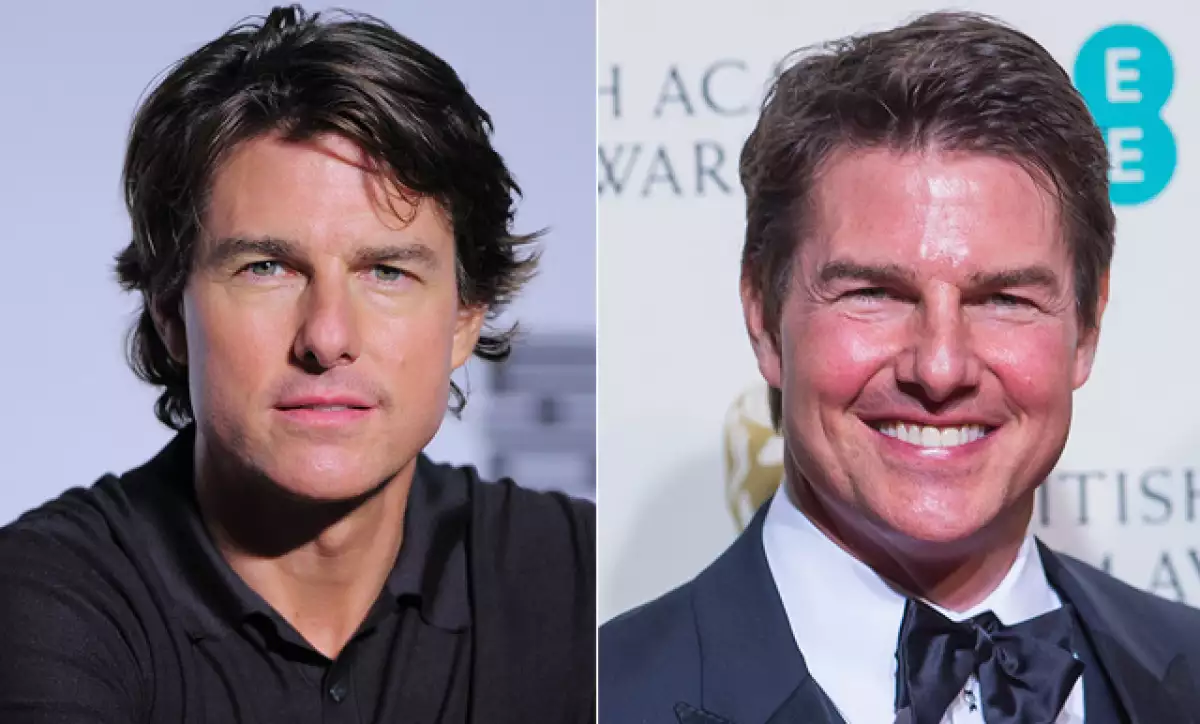 El actor fue uno de los presentadores de la ceremonia de premios, en la que levantó sospechas de un exceso de botox o de haberse realizado una cirugía estética.