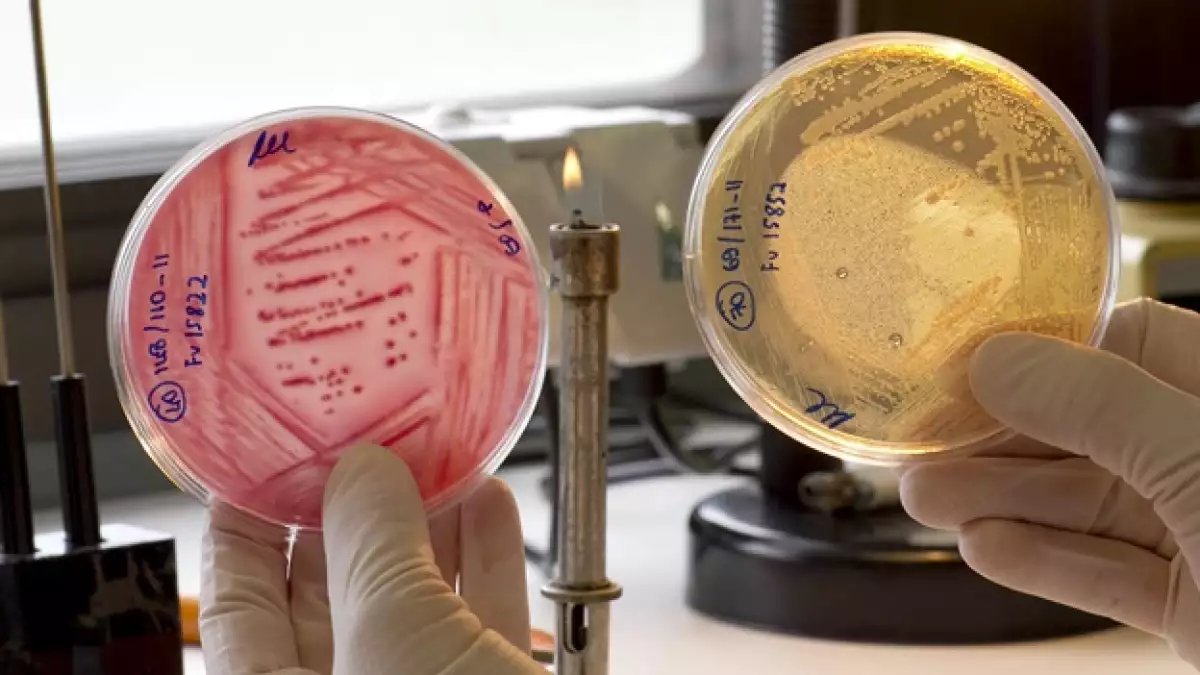 pruebas de laboratoria del e. coli