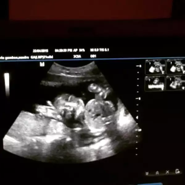 Esta es la primera foto del bebé de Sandra Echeverría y Leo de Lozanne, quienes todavía no se han decidido por el nombre.