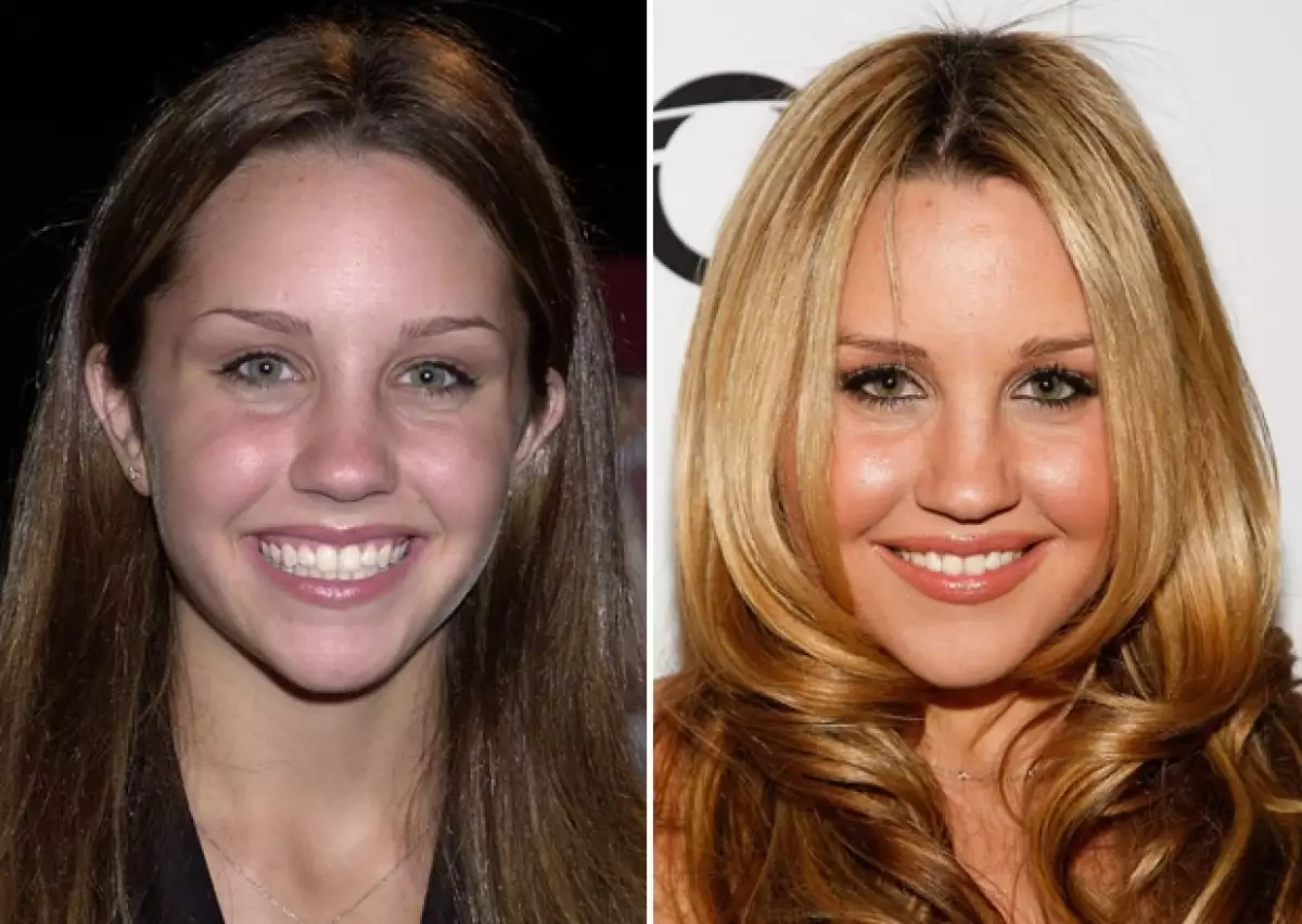 El antes y el después de Amanda Bynes.
