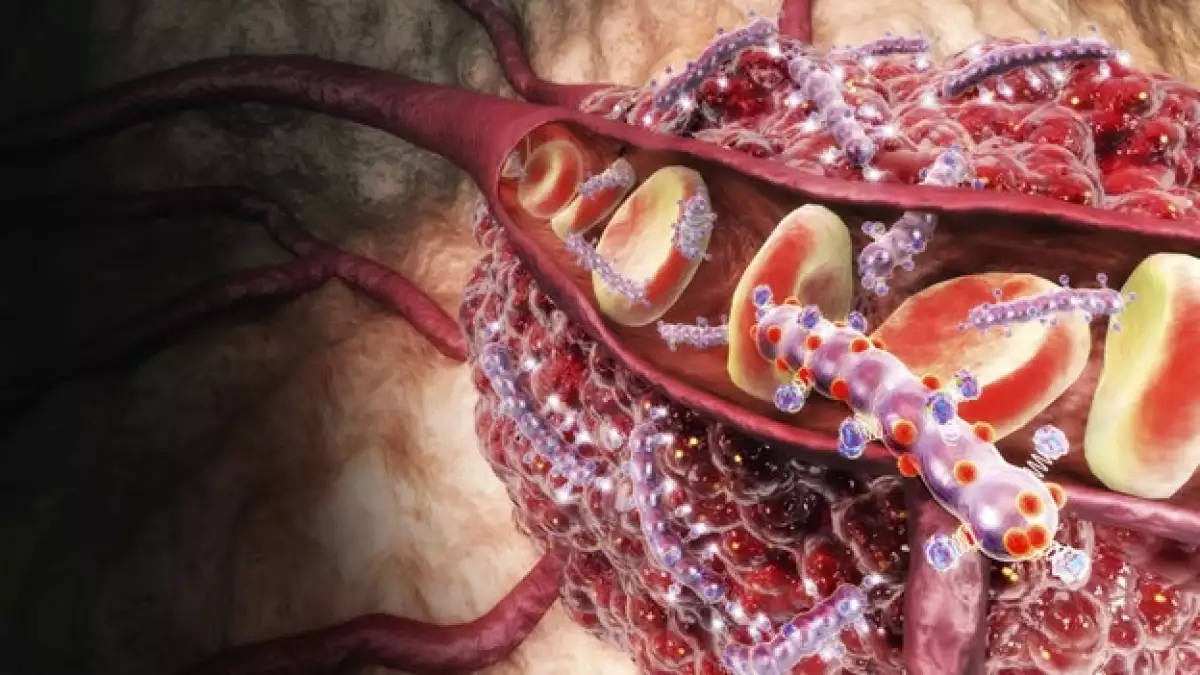 nanotecnología nanoworm cancer