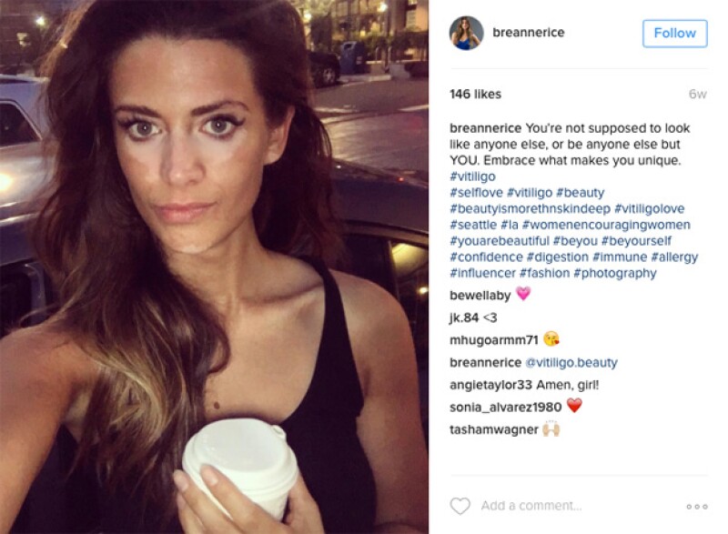 Breanne Rice se mostró al natural desde marzo de 2016.