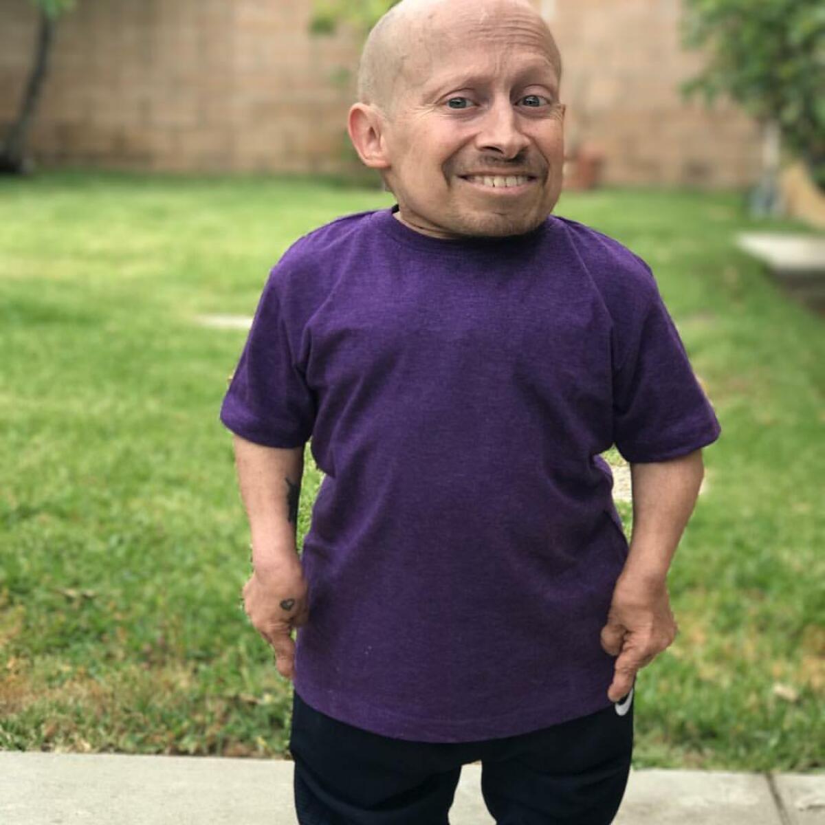 Muere Verne Troyer, intérprete de ‘Mini me’ en la cinta Austin Powers