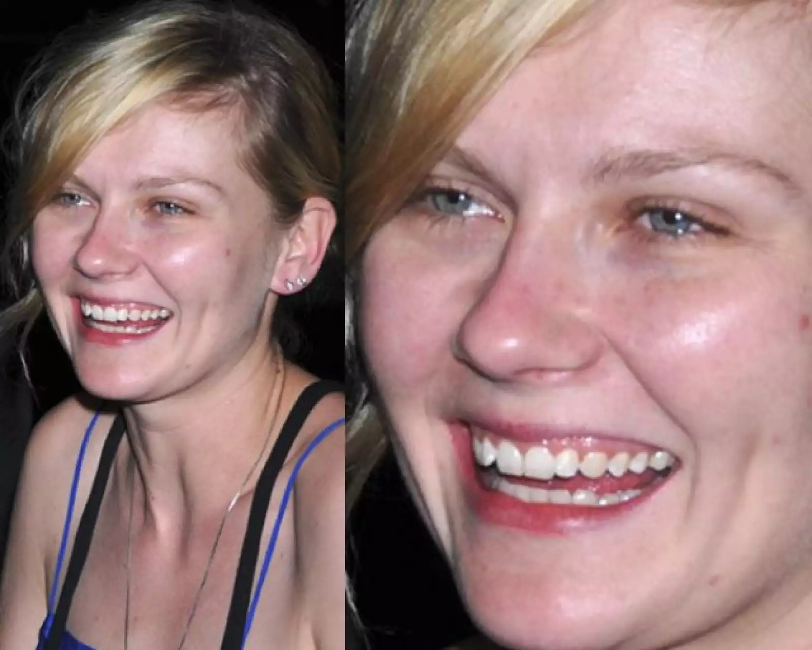 Kirsten Dunst sabe que sus dientes están chuecos, pero no le importa pues ella lo sabe y no desea ponerle remedio a su sonrisa que podría estar mucho mejor.
