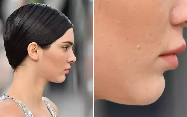 Kendall Jenner
