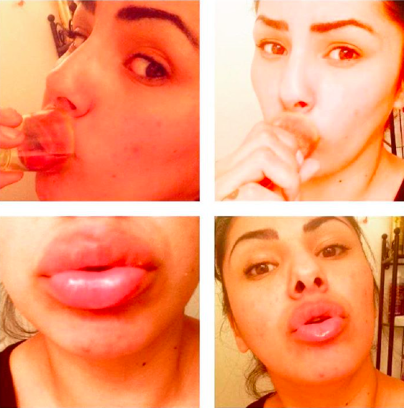 Todos querían los labios de Kylie e hicieron este reto.