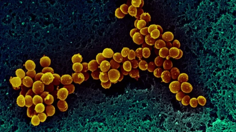 Microorganismo similar a la arquea