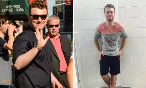 A pesar de haberse quemado gravemente su piel por el sol, Sam dejó ver lo fit que luce su cuerpo con una t-shirt deportiva.
