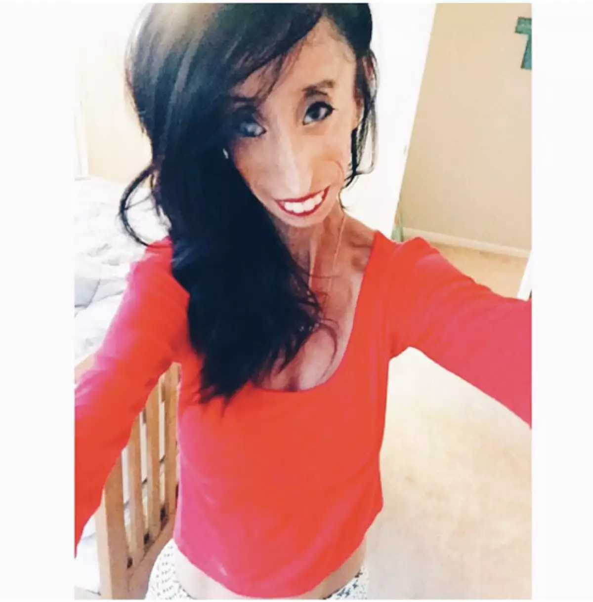 La chica que había sido nombrada la mujer más fea del mundo.