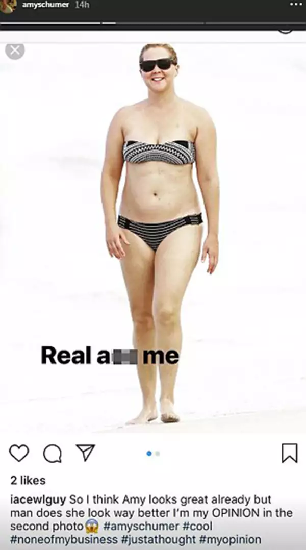 Amy Schumer