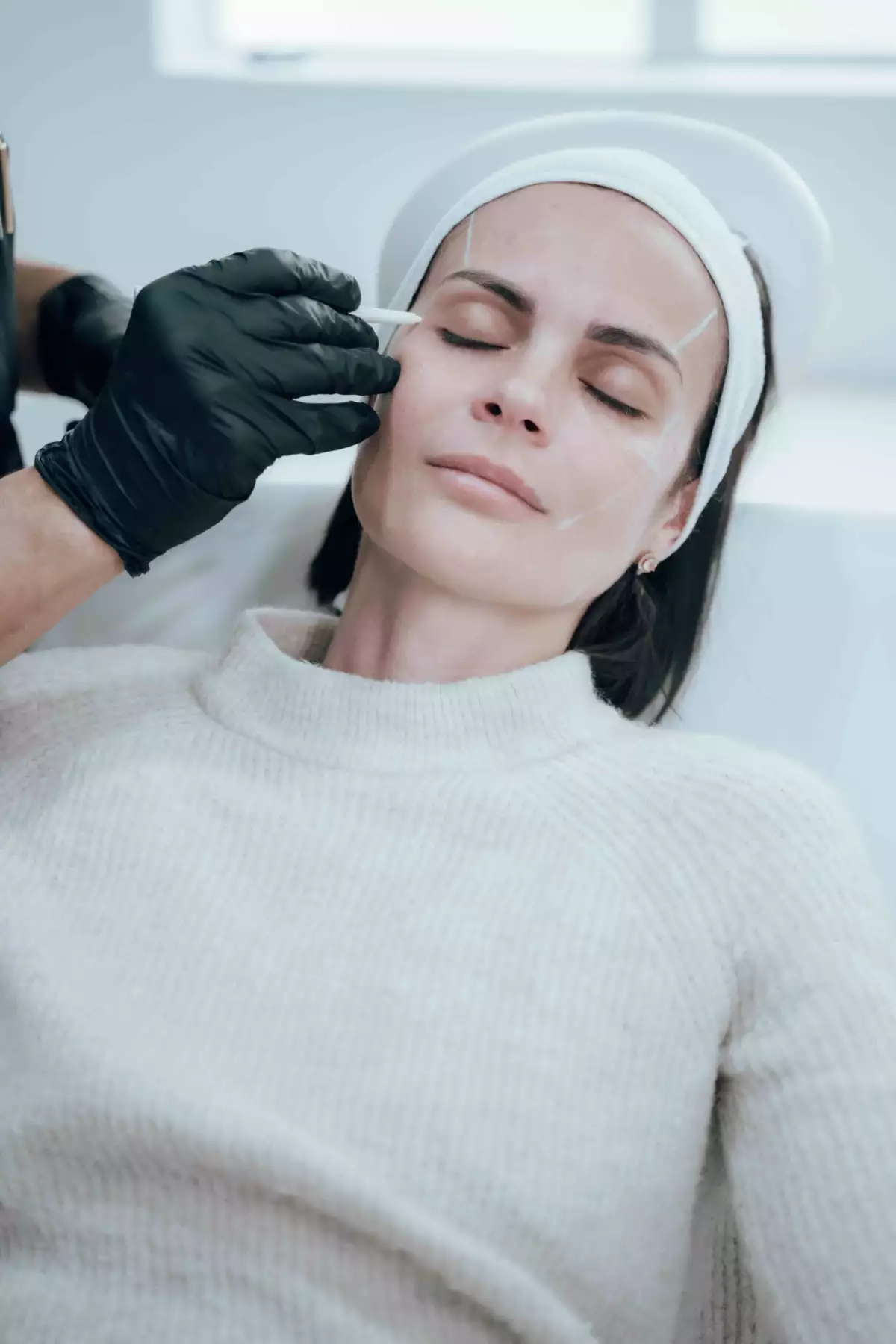 tratamiento skin booster
