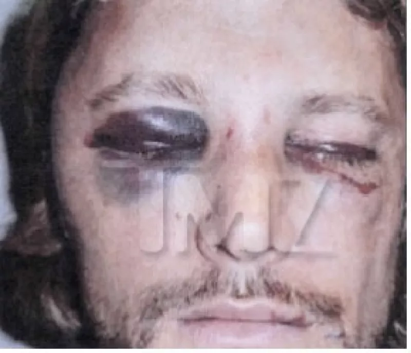 De acuerdo con el portal TMZ, la declaración de Gabriel Aubry, respaldada por fotografías, pinta un cuadro totalmente diferente al que se había difundido luego del pleito.