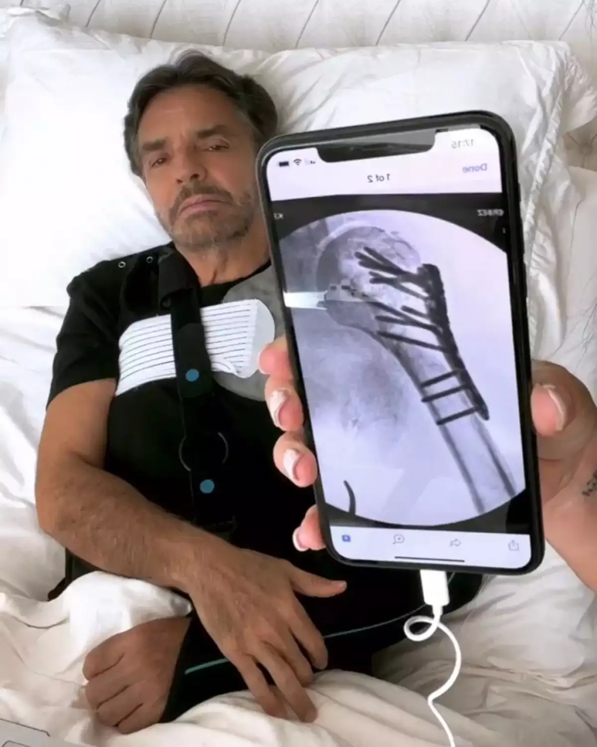 Eugenio Derbez rompió el silencio sobre su accidente