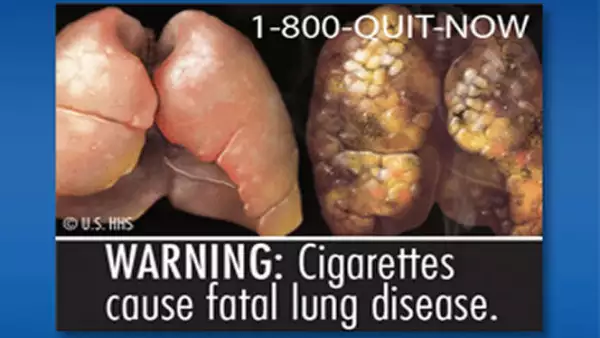 Las explícitas fotos buscan ilustrarle al consumidor los efectos nocivos de fumar.