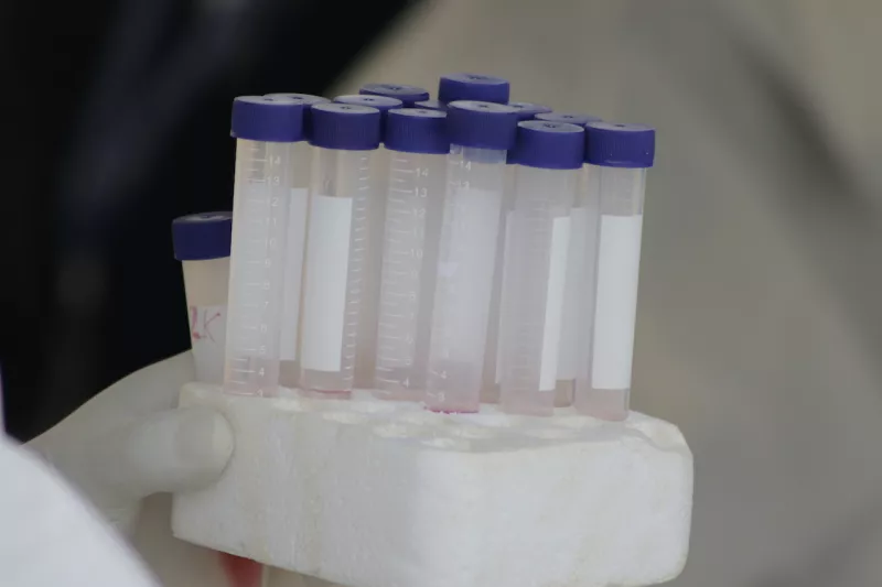 Virus Outbreak Mexico 