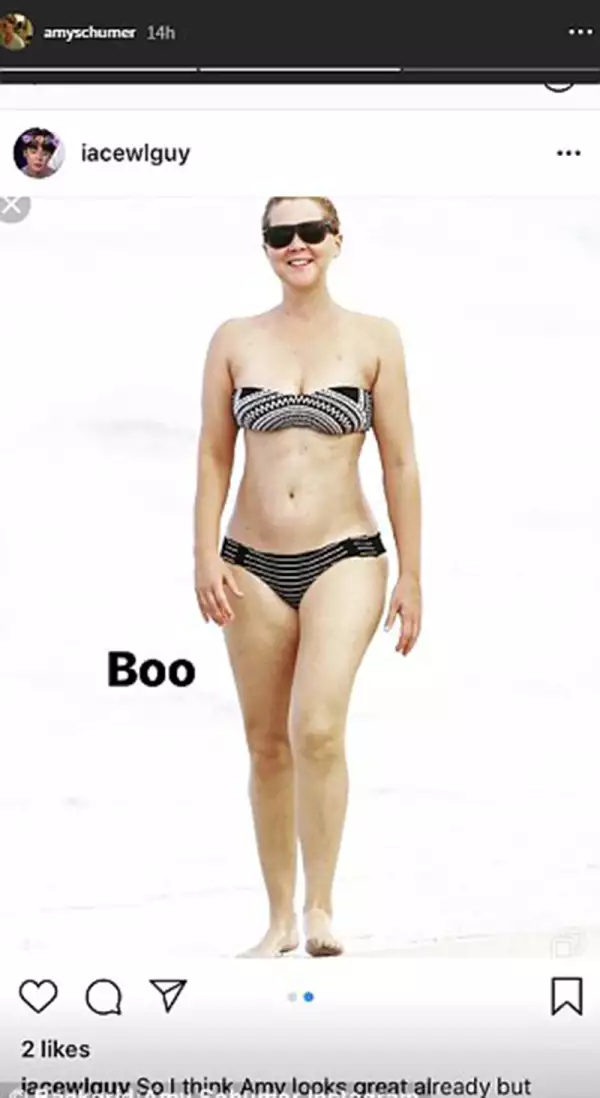 Amy Schumer
