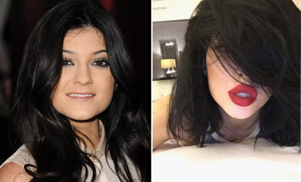 Desde Kylie Jenner hasta Renée Zellweger, hay famosas que pese a lo diferentes que se ven han negado haberse hecho cambios estéticos.