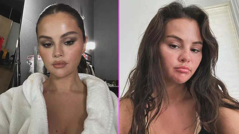 Selena Gomez tratamientos estéticos