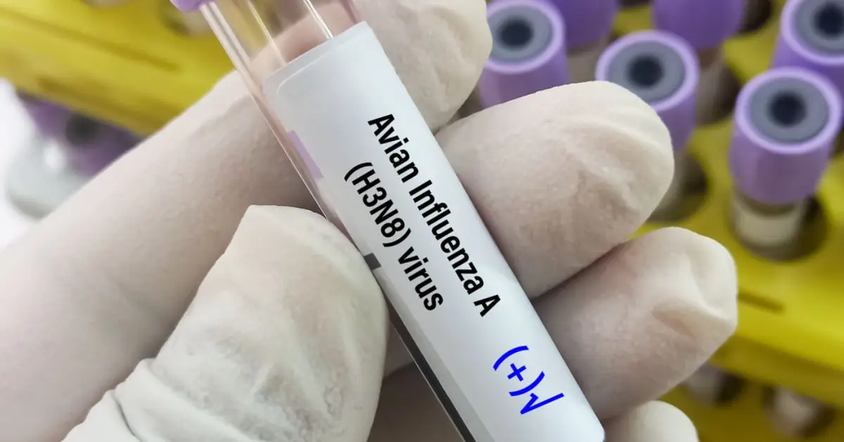 Muestra de sangre positiva para la prueba del virus de la influenza aviar tipo A (H3N8), el virus de la influenza aviar (AIV), la gripe aviar o la gripe aviar.