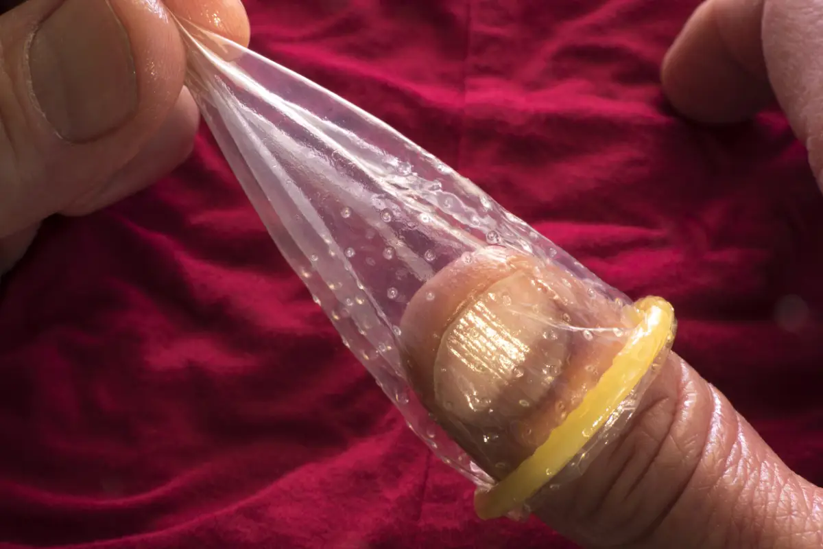 Condon stealthing.