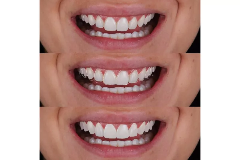 Plan-B-diseñosonrisas-1.jpg