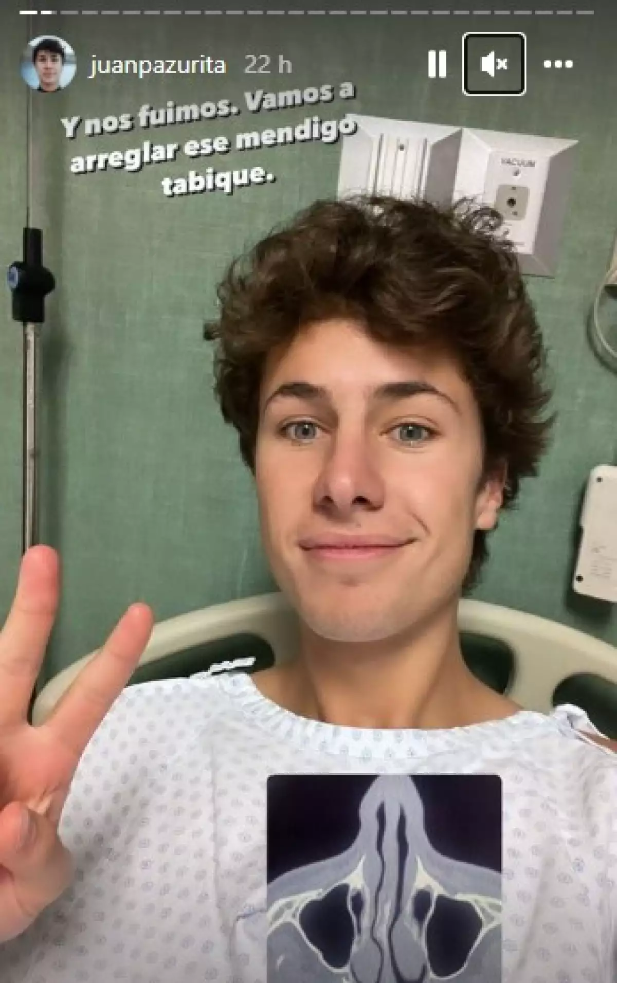 Juanpa Zurita